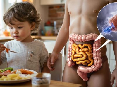 Wie Darmbakterien bei Kindern Darmkrebs früh auslösen können